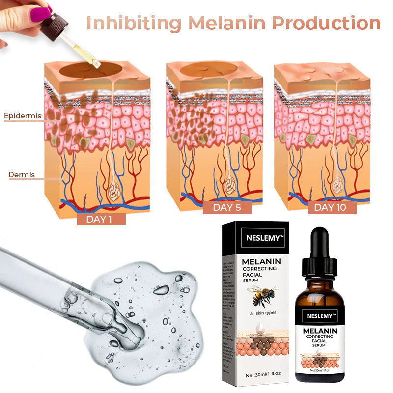 ✨Fast, Effective Dark Spot Treatment – NESLEMY™ Melanin Correcting Facial Serum