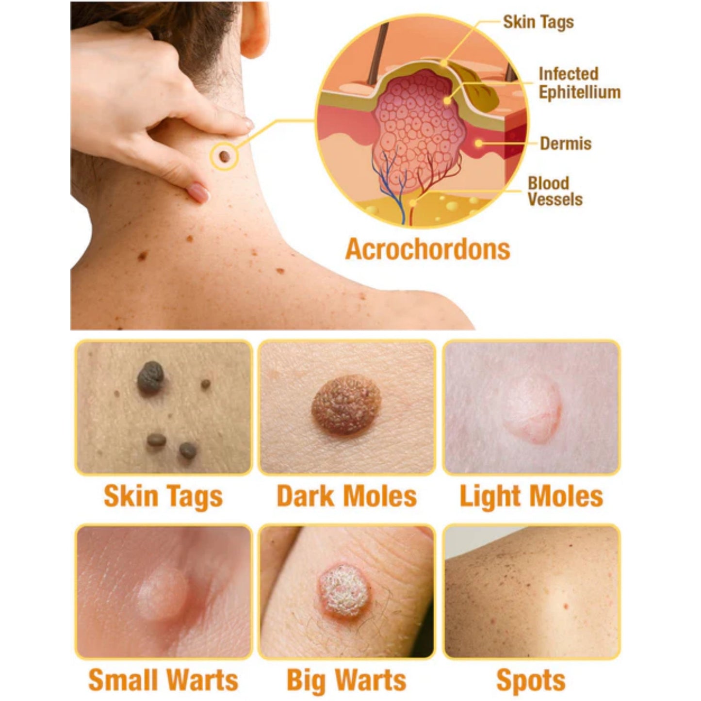 (š„LAST DAY 70% OFF) šLOVILDS⢠TagRecede Bee Poison Treatment Spray