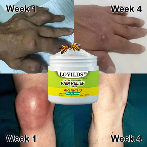 🐝New Zealand Bee Poison Joint and Bone Therapy Advanced Cream⏳Limited time discount of 80%⏳