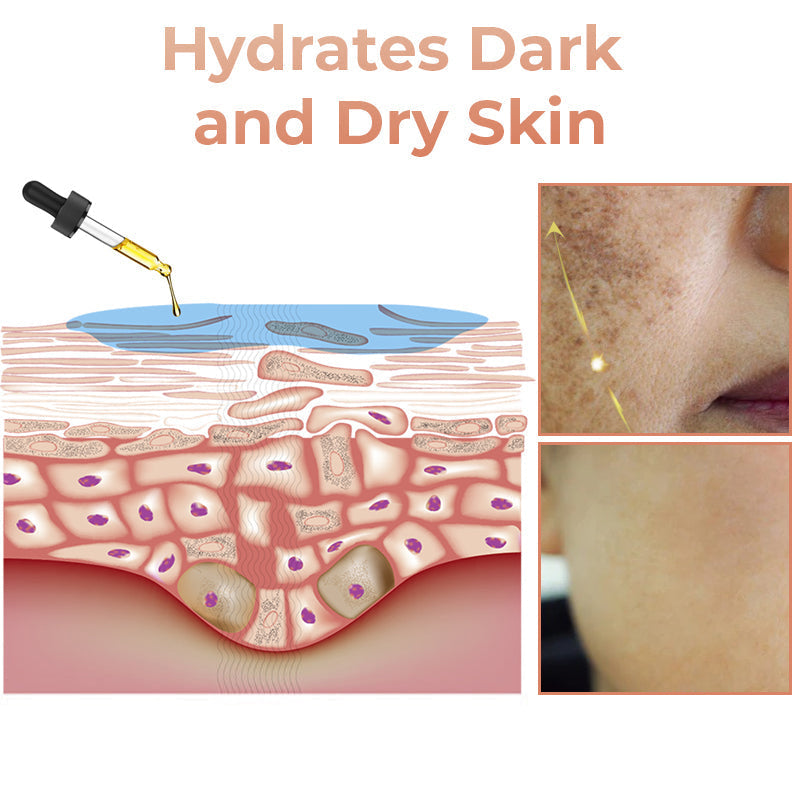 ✨Fast, Effective Dark Spot Treatment – NESLEMY™ Melanin Correcting Facial Serum