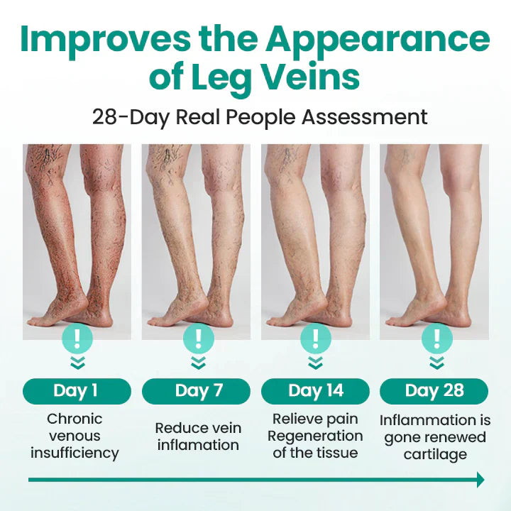 Newyuo® LegRenew Varicose Veins Patch