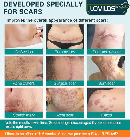 ❤️LOVILDS™ Advanced Scar Spray For All Types of Scars - For example Acne Scars, Surgical Scars and Stretch Marks ⚡️⚡️⚡️
