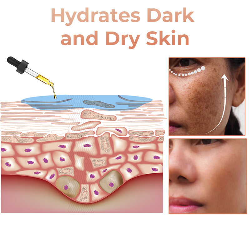 (🔥LAST DAY SALE-70% OFF)-Fast Dark Spot Remover-NESLEMY™ Turmeric Spot Repair Serum