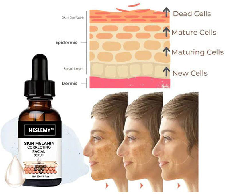 ✨Fast, Effective Dark Spot Treatment – NESLEMY™ Melanin Correcting Facial Serum
