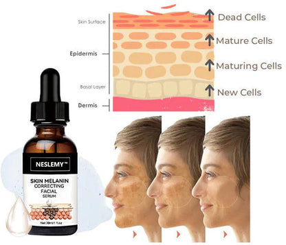 ✨Fast, Effective Dark Spot Treatment – NESLEMY™ Melanin Correcting Facial Serum