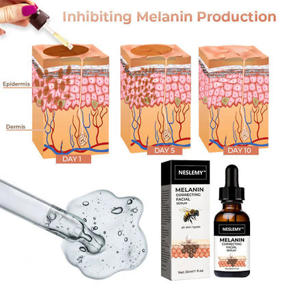 ✨Fast, Effective Dark Spot Treatment – NESLEMY™ Melanin Correcting Facial Serum