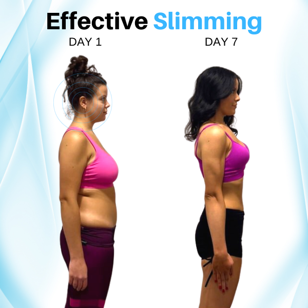 (🔥LAST DAY 70% OFF)  Histone™ Slimming Earrings