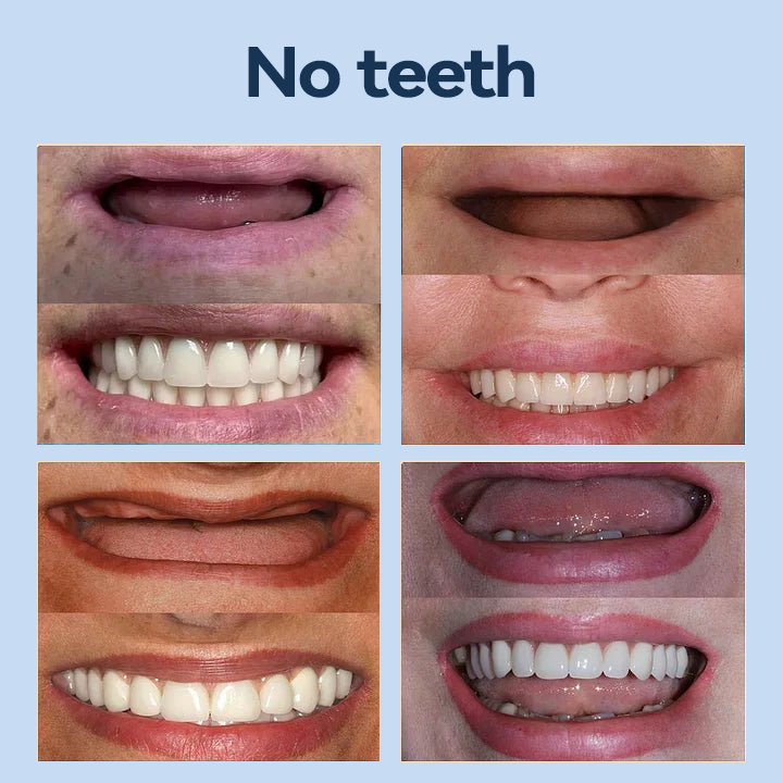 SmileFitPro® – 𝐌𝐞𝐝𝐢𝐜𝐚𝐥𝐅𝐢𝐭 𝐀𝐝𝐚𝐩𝐭𝐢𝐯𝐞 𝐃𝐞𝐧𝐭𝐮𝐫𝐞𝐬🦷Suitable for all mouth shapes, perfect fit🦷(⏰Limited time 50% off, last 30 minutes⏰)