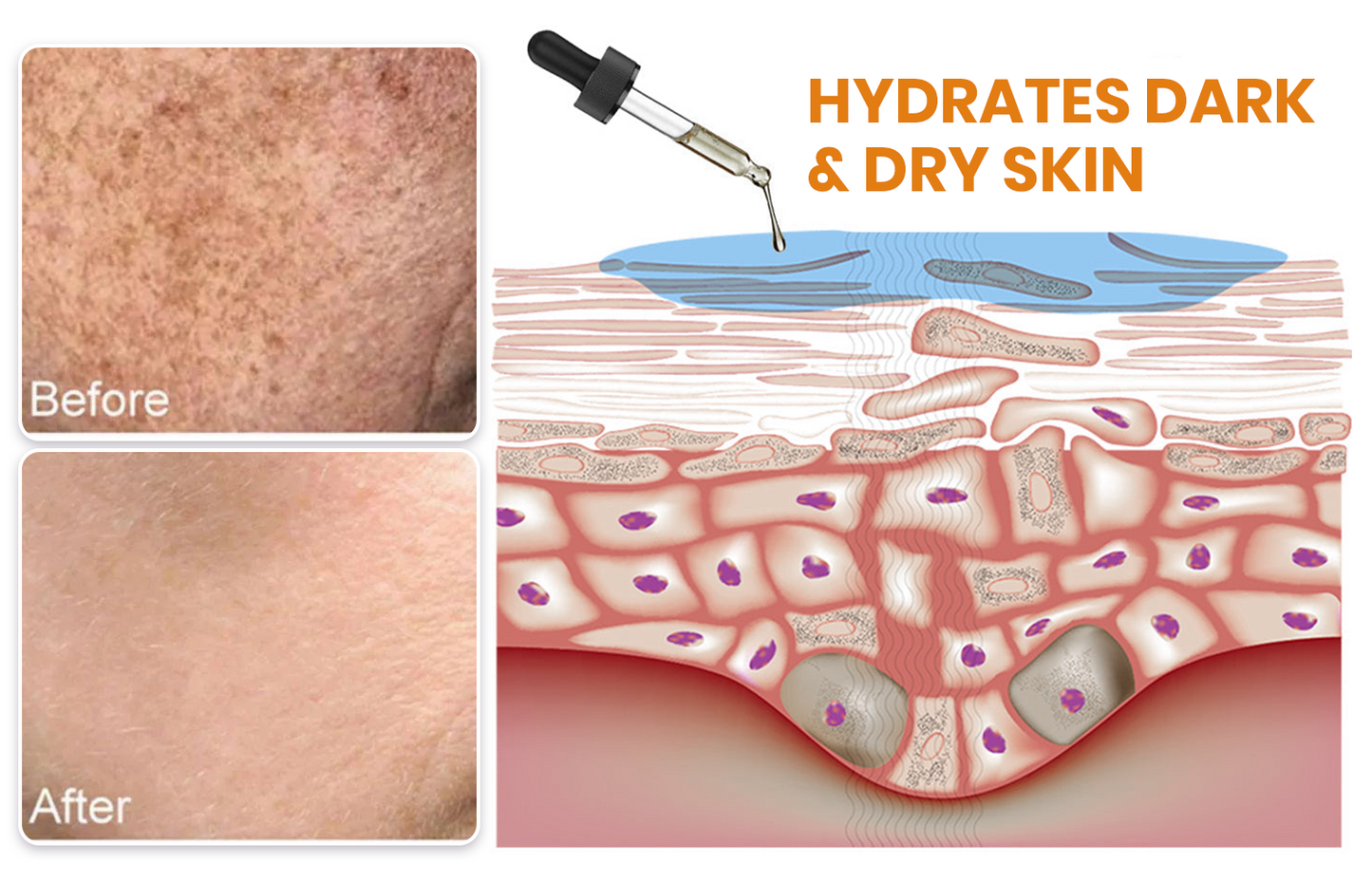✨Fast Dark Spot Remover-NEWYUO™ Melanin Correcting Facial Serum