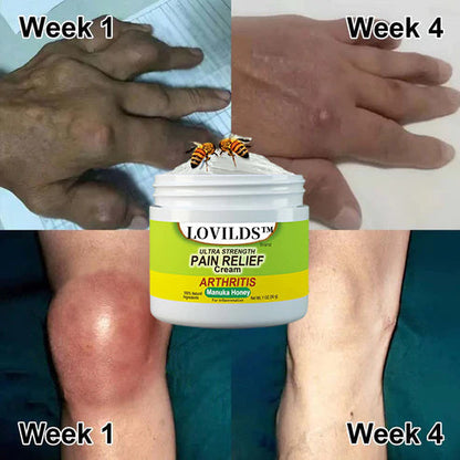 🐝New Zealand Bee Poison Joint and Bone Therapy Advanced Cream