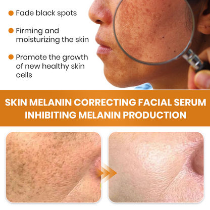✨Fast Dark Spot Remover-NEWYUO™ Melanin Correcting Facial Serum