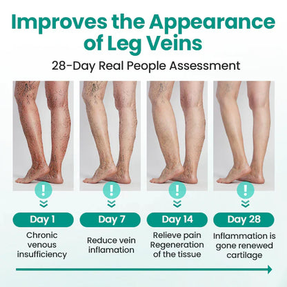 Newyuo® LegRenew Varicose Veins Patch