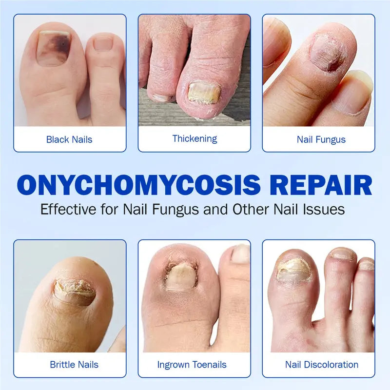 NESLEMY® Nail Fungus Care Patches