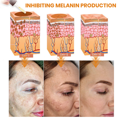 ✨Fast Dark Spot Remover-NEWYUO™ Melanin Correcting Facial Serum