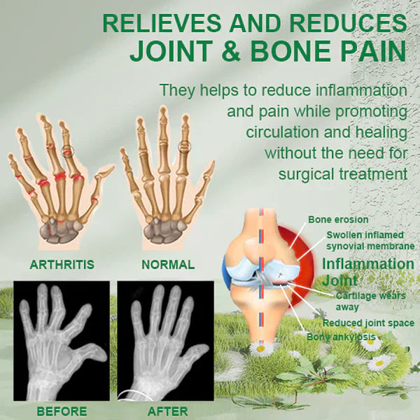 🐝New Zealand Bee Poison Joint and Bone Therapy Advanced Cream