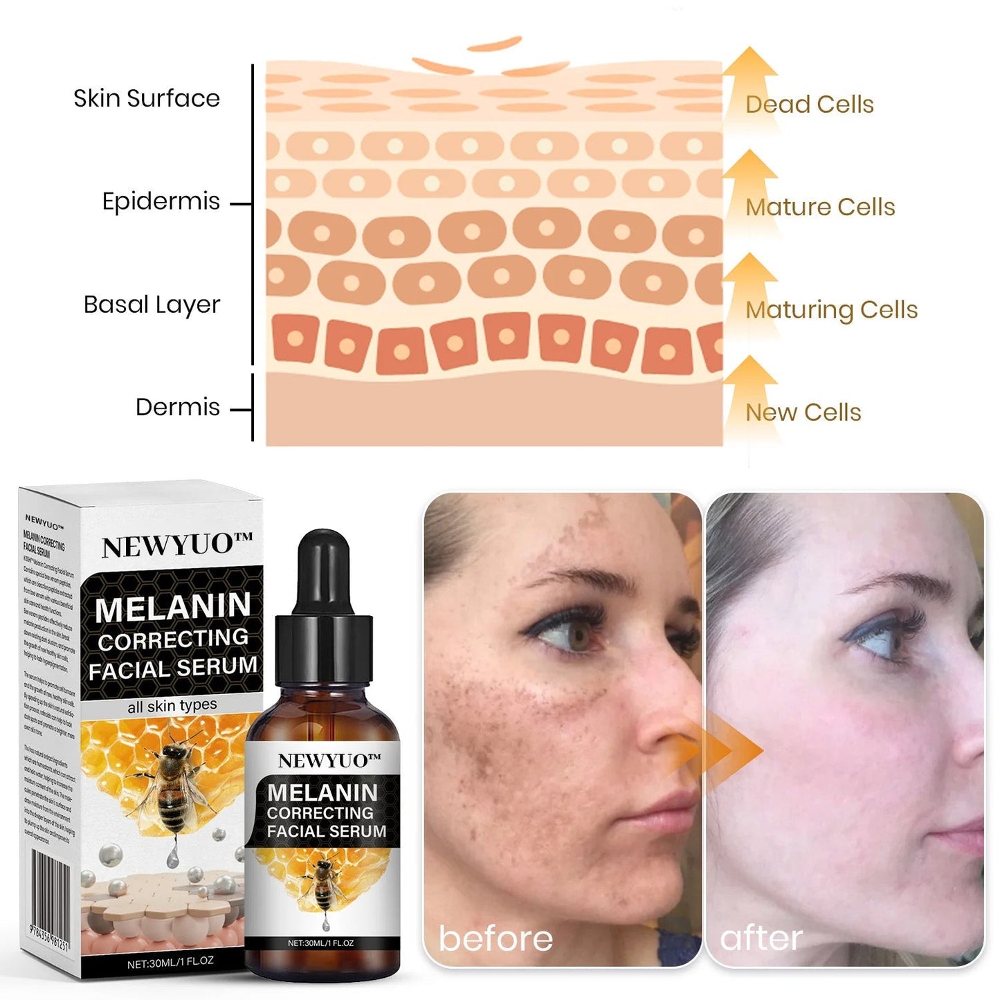 ✨Fast Dark Spot Remover-NEWYUO™ Melanin Correcting Facial Serum
