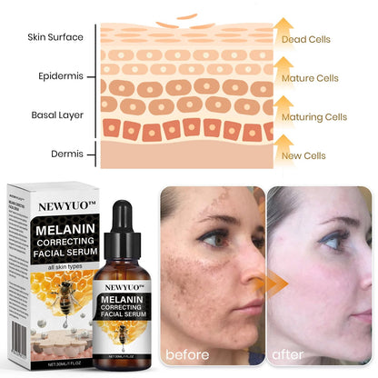 ✨Fast Dark Spot Remover-NEWYUO™ Melanin Correcting Facial Serum