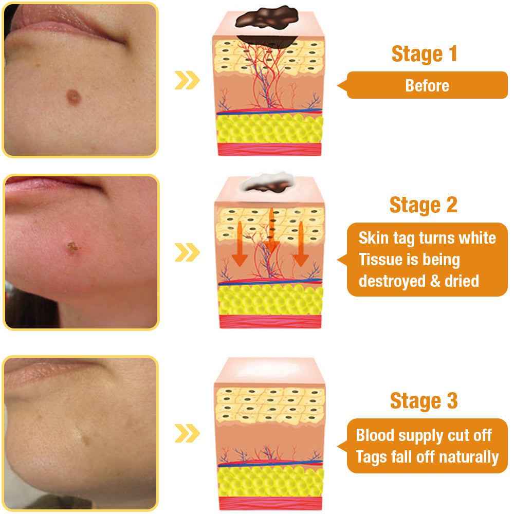 (🔥LAST DAY 70% OFF) 🐝LOVILDS™ TagRecede Bee Poison Treatment Spray