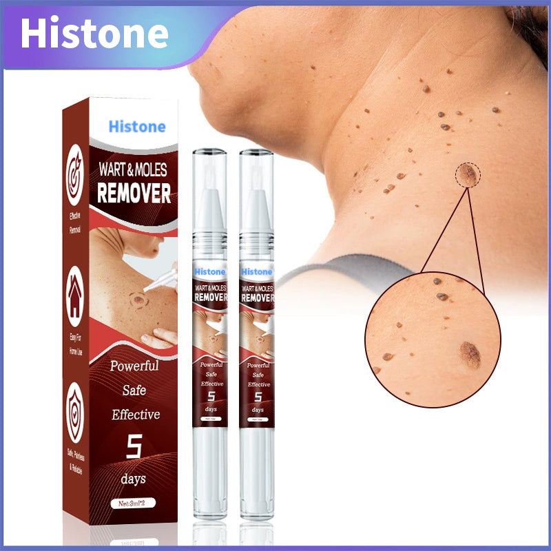Histone™ Tags & Moles Remover