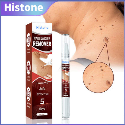 Histone™ Tags & Moles Remover