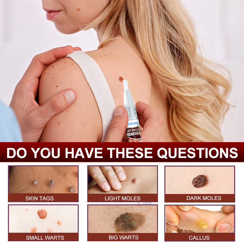 Histone™ Tags & Moles Remover