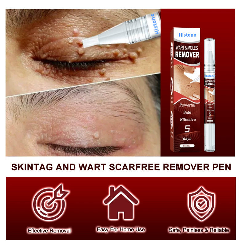 Histone™ Tags & Moles Remover