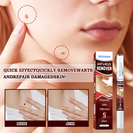 Histone™ Tags & Moles Remover