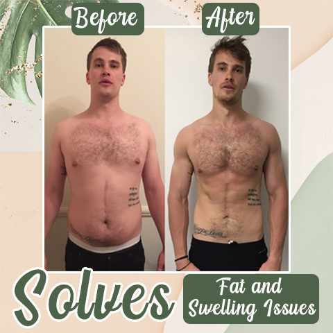 Lovilds™ Perfect Detox Slimming Patch（Limited Time Discount 🔥 Last Day）