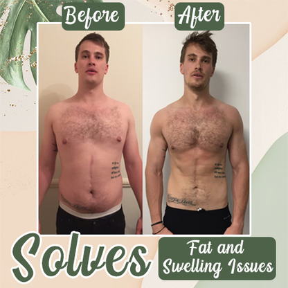 Lovilds™ Perfect Detox Slimming Patch（Limited Time Discount 🔥 Last Day）