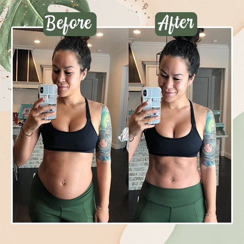 Lovilds™ Perfect Detox Slimming Patch（Limited Time Discount 🔥 Last Day）