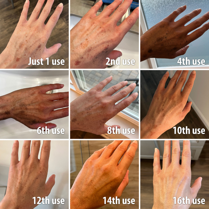(🔥LAST DAY SALE-70% OFF)-Fast Dark Spot Remover-NESLEMY™ Turmeric Spot Repair Serum