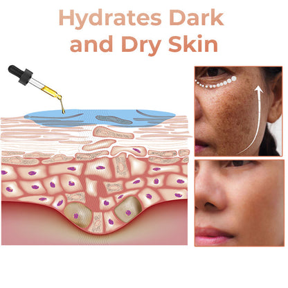(🔥LAST DAY SALE-70% OFF)-Fast Dark Spot Remover-NESLEMY™ Turmeric Spot Repair Serum